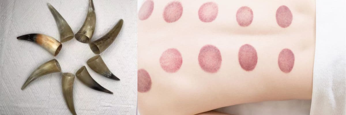 Hijama with Horns Hijama with Horns