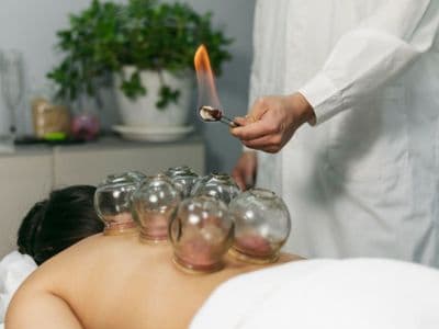 Hijama with Cupping Hijama with Cupping
