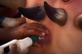 Hijama with Horns Hijama with Horns